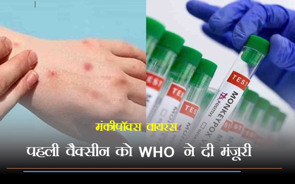 मंकीपॉक्स वायरस कि पहली वैक्सीन को WHO ने दी मंजूरी