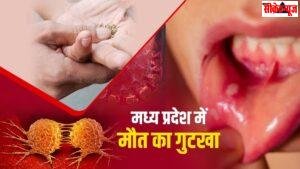 मध्य प्रदेश के लोगों को निगल रहा गुटखा, तंबाकू ने माउथ कैंसर के मरीज 40 फीसदी बढ़ाए, देश में सबसे ज्यादा मामले यहां